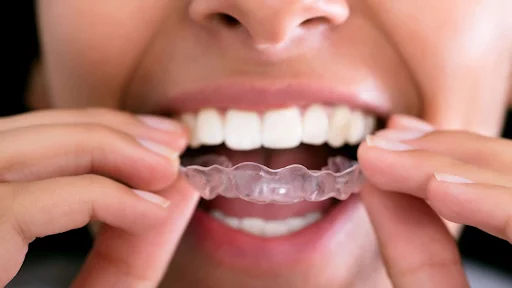 5 Common Reasons for Chattering Teeth